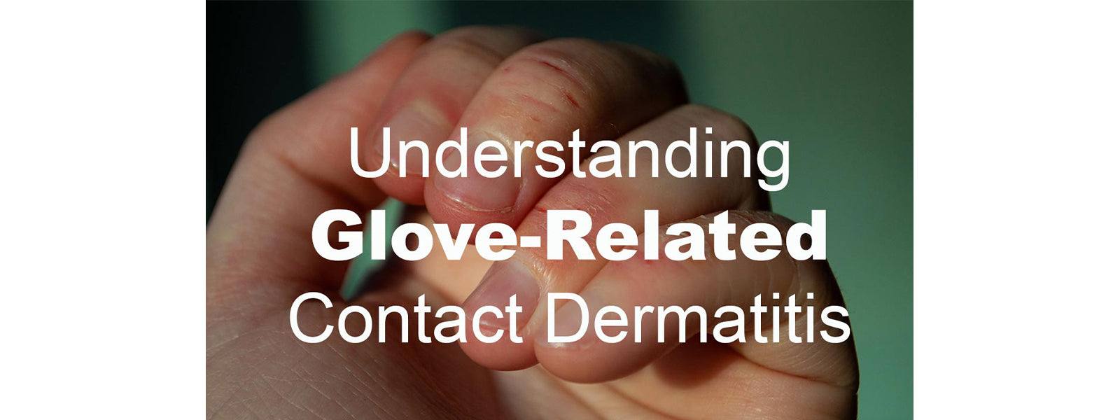Glove-Related Dermatitis: Understanding the Itch Behind the Gloves - VizoCare